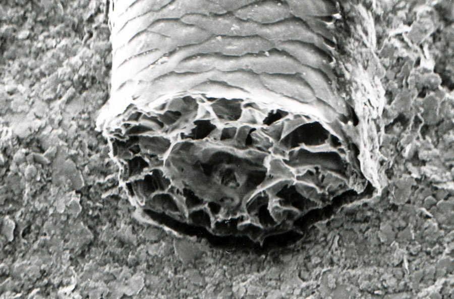 klipspringer hair Electron microscope